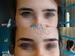 Eyebrow Threading (Before and After)