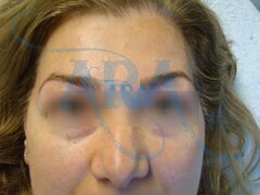 Eyebrow Threading
