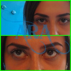 Eyebrow Threading