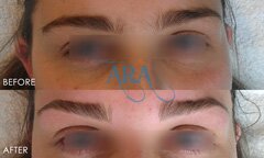 Eyebrow Threading (Before and After)