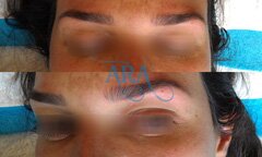 Eyebrow Threading (Before and After)