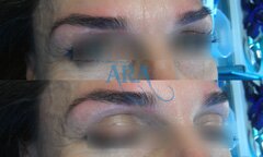 Eyebrow Threading (Before and After)
