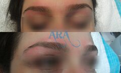 Eyebrow Threading (Before and After)