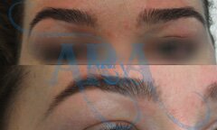 Eyebrow Threading (Before and After)