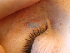 Eyebrow Threading (Before and After)